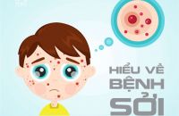 Bệnh Sởi - Nguy cơ lớn nhưng có thể phòng ngừa